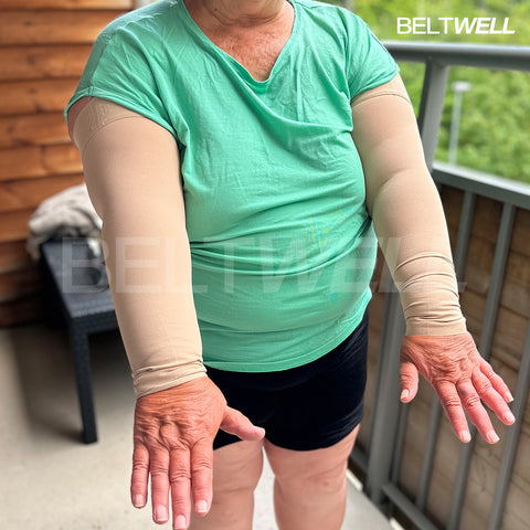 Beltwell® - The Plus-Size Lymphedema Arm Compression Sleeves For Swollen Arms (1 pair)