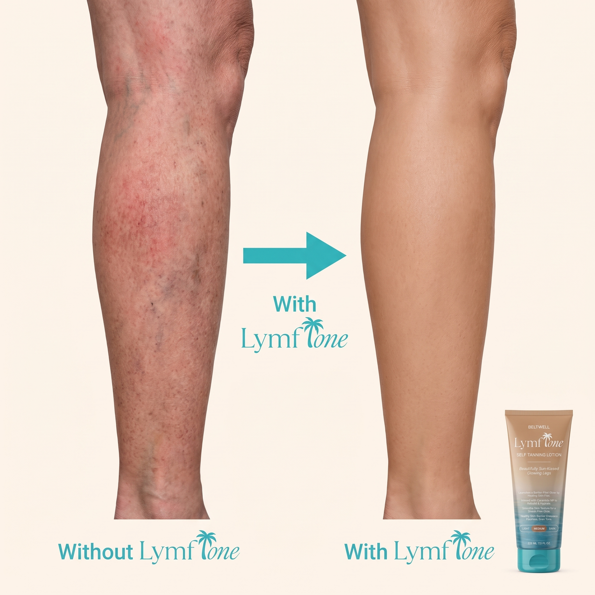 LymfTone Self-Tanner & Extra Glow for Legs With TrueTone Complex™