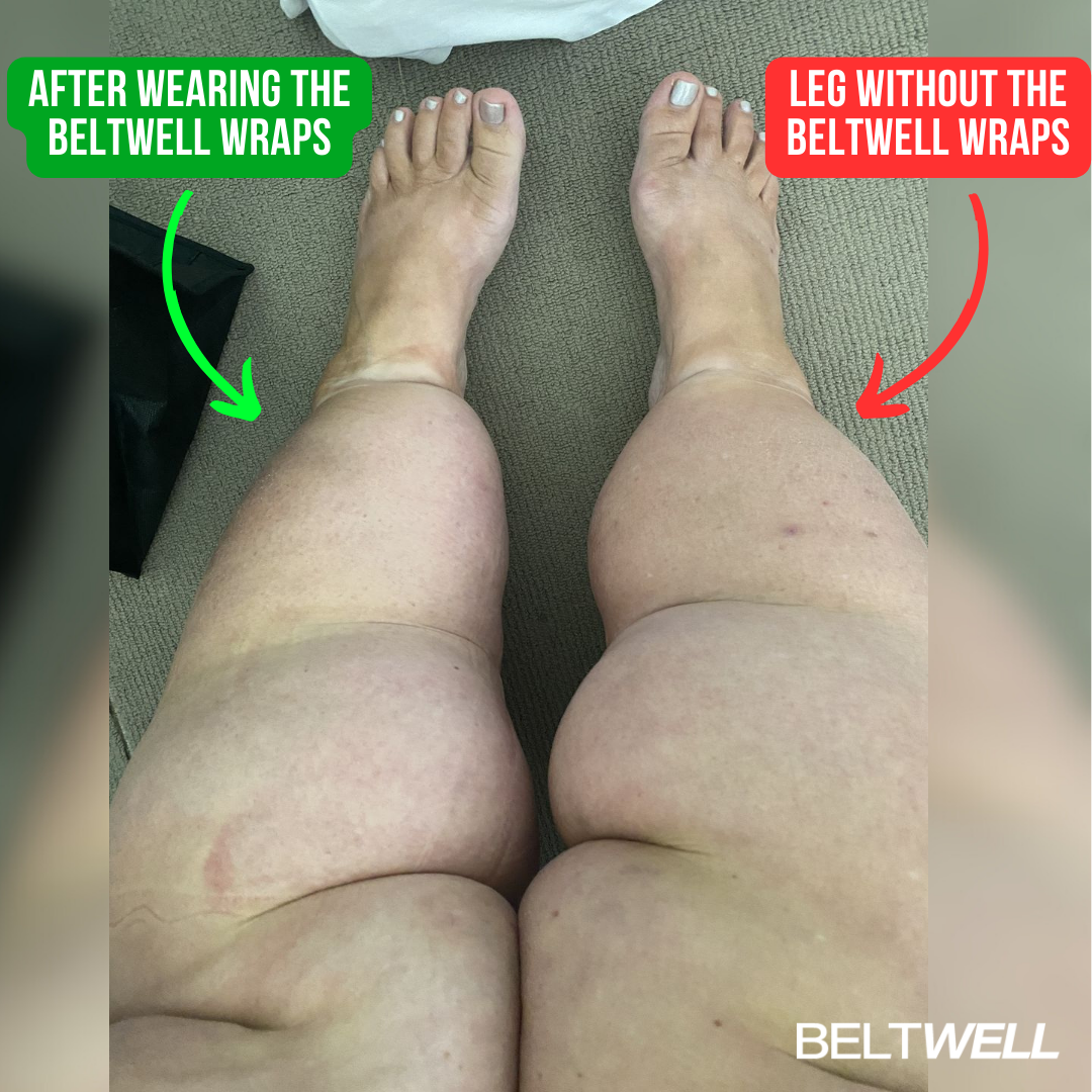 Beltwell®  The Full Plus-Size Leg Compression Bundle (Foot, Calf, Thigh) + 8 FREE Bonuses