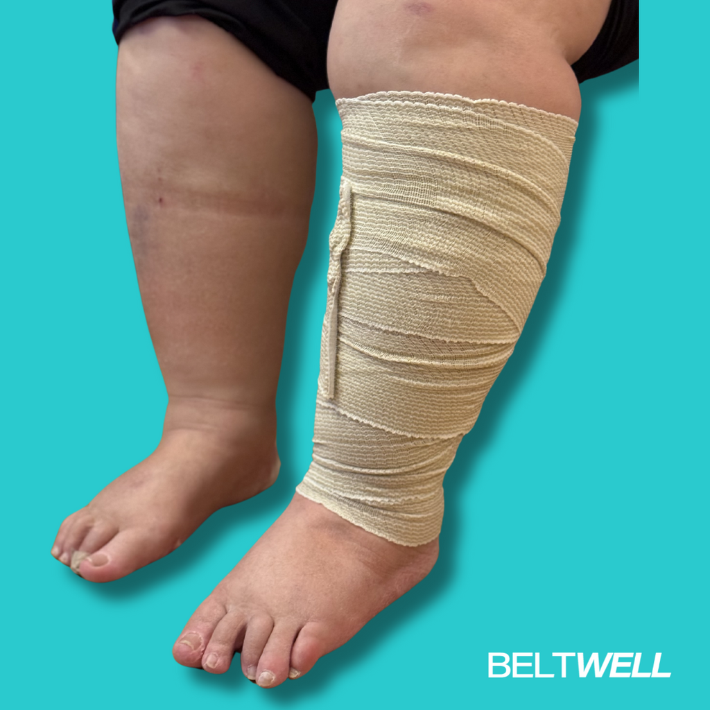 Beltwell® - Compression Bandage For Big Legs With Velcro (4 Bandages) –  Beltwell-com