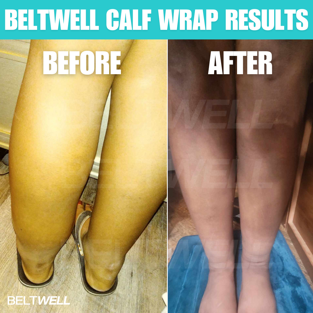 Beltwell® The Full Leg Compression Bundle (Foot, Calf, Thigh) + 8 FREE Bonuses | BLACK