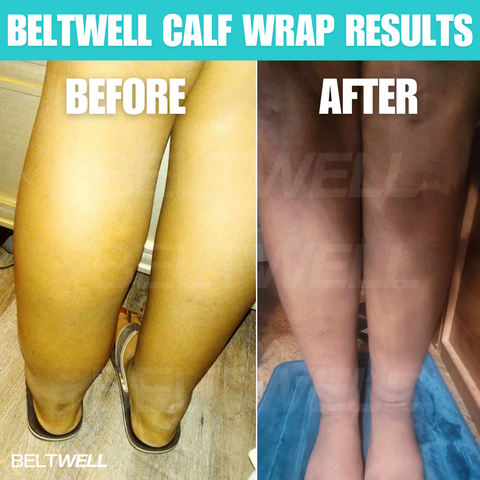 Beltwell® LymphoTech™ - The NEW Advanced Lymphatic Compression Technology for Big, Swollen Calves (1 wrap)