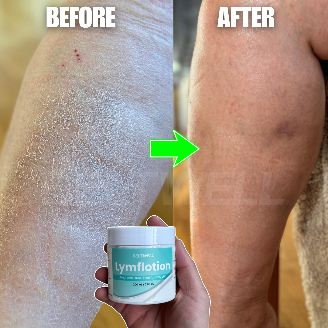 Lymphatic Support Fragrance-Free Non-Greasy Anti-Itch Ceramide NP Lotion