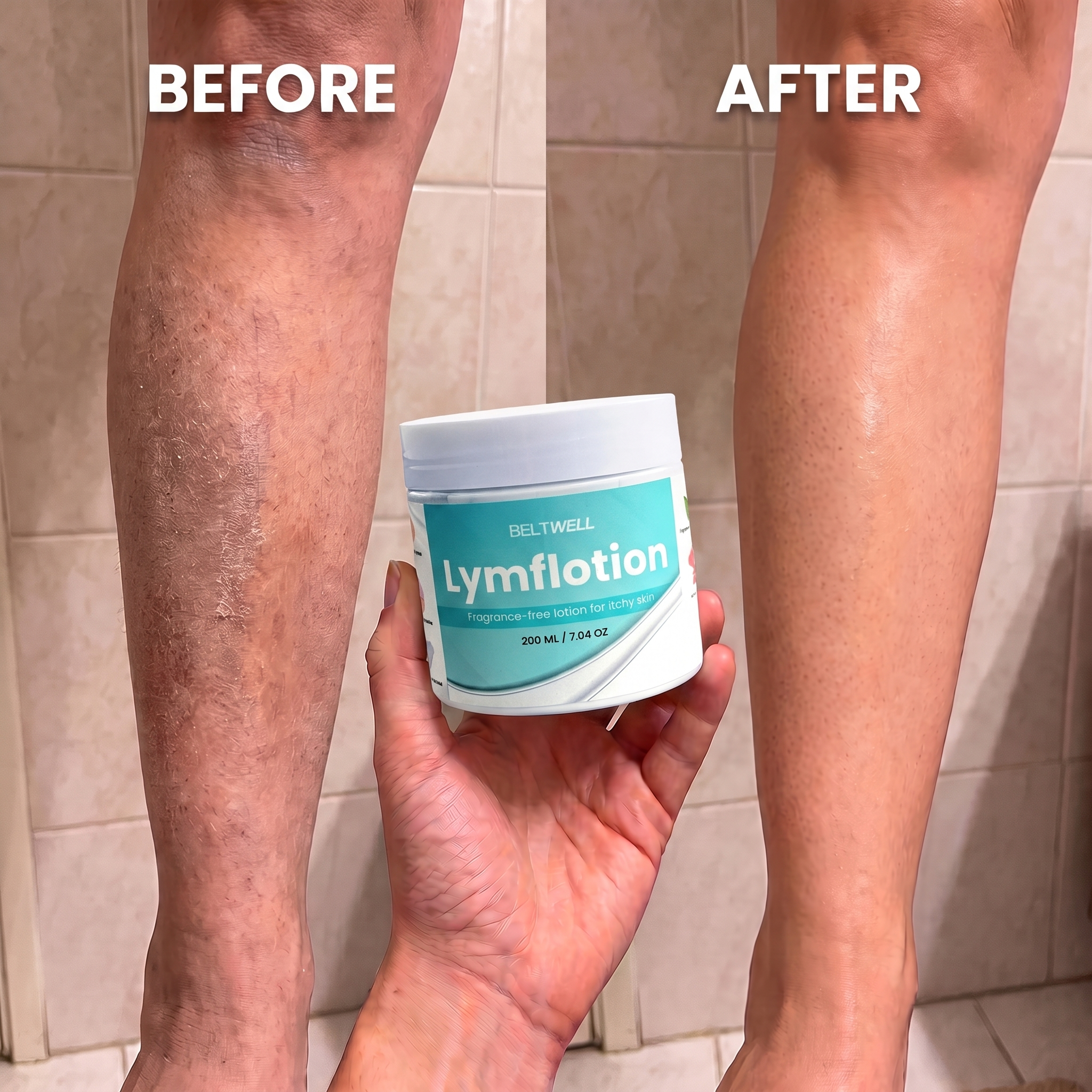 Fragrance-Free Non-Greasy Anti-Itch Ceramide NP Leg Lotion For Dry, Red, Sensitive, Discolored, Crepey Skin